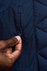 Women Detachable-Hood Thickened Down Jacket